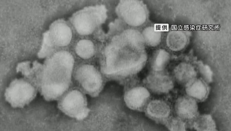 インフルエンザウイルス（提供：国立感染症研究所）