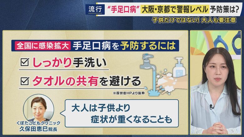 手足口病を予防する対策は…