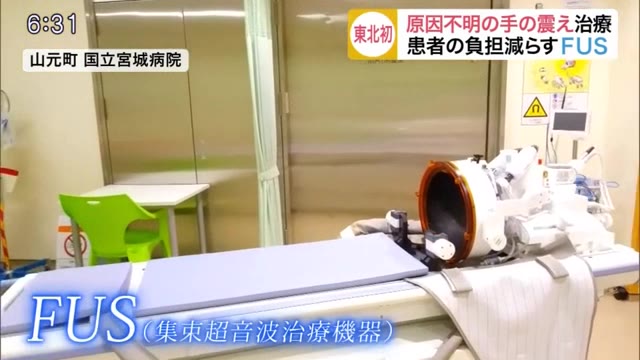 原因不明の手の震え「本態性振戦」に新たな治療 東北初導入 患者の負担減らす「FUS」〈宮城〉