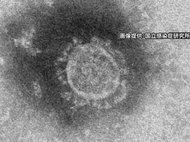 70代妻も現在重症…クラスター発生した“合唱団”の70代新型コロナ感染者が死亡 岐阜県内で初