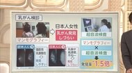 3分でわかるキーワード 上皇后さまも...早期の乳がん