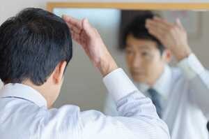 「笑ってごまかす」人が大半…薄毛気にする人の75%が“髪ハラ”を受けている