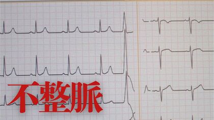 やっていますか？検脈　無症状も…放置すると心不全や脳梗塞の恐れある「不整脈」　受診の目安とセルフチェック方法　