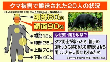 恐怖】目の下を4針縫うケガ…被害女性（82）語るクマに襲われた瞬間