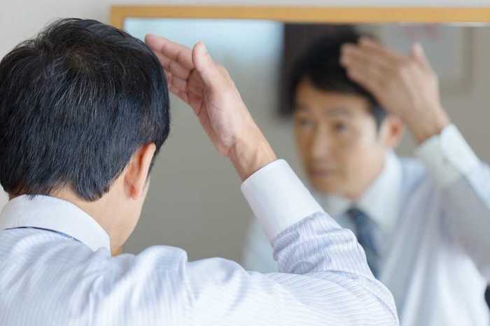 「笑ってごまかす」人が大半…薄毛気にする人の75%が“髪ハラ”を受けている