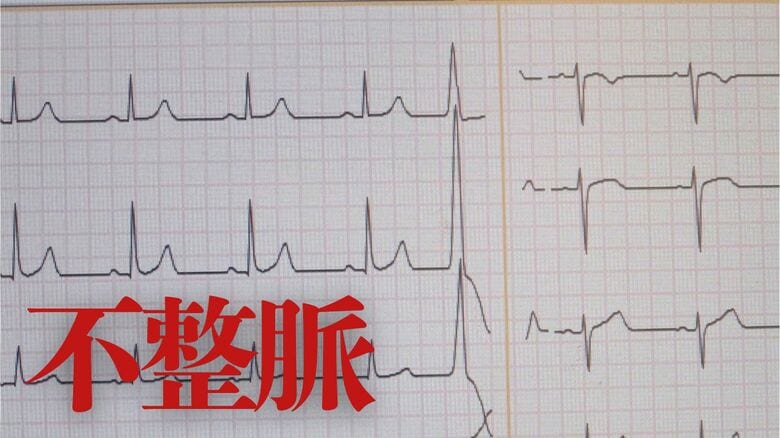 やっていますか？検脈　無症状も…放置すると心不全や脳梗塞の恐れある「不整脈」　受診の目安とセルフチェック方法　｜FNNプライムオンライン