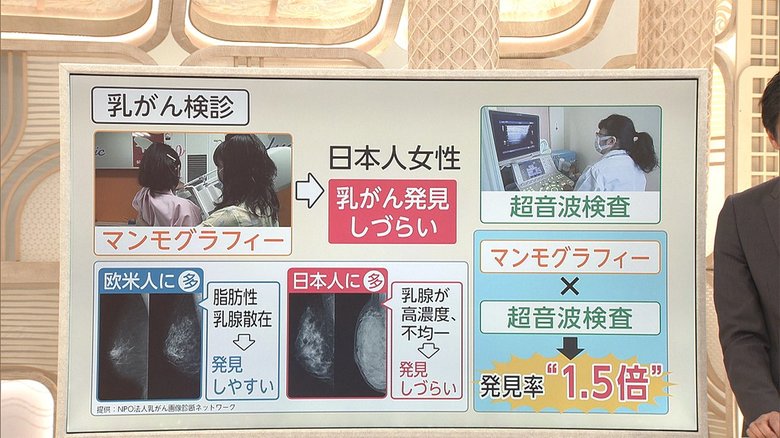 3分でわかるキーワード 上皇后さまも...早期の乳がん