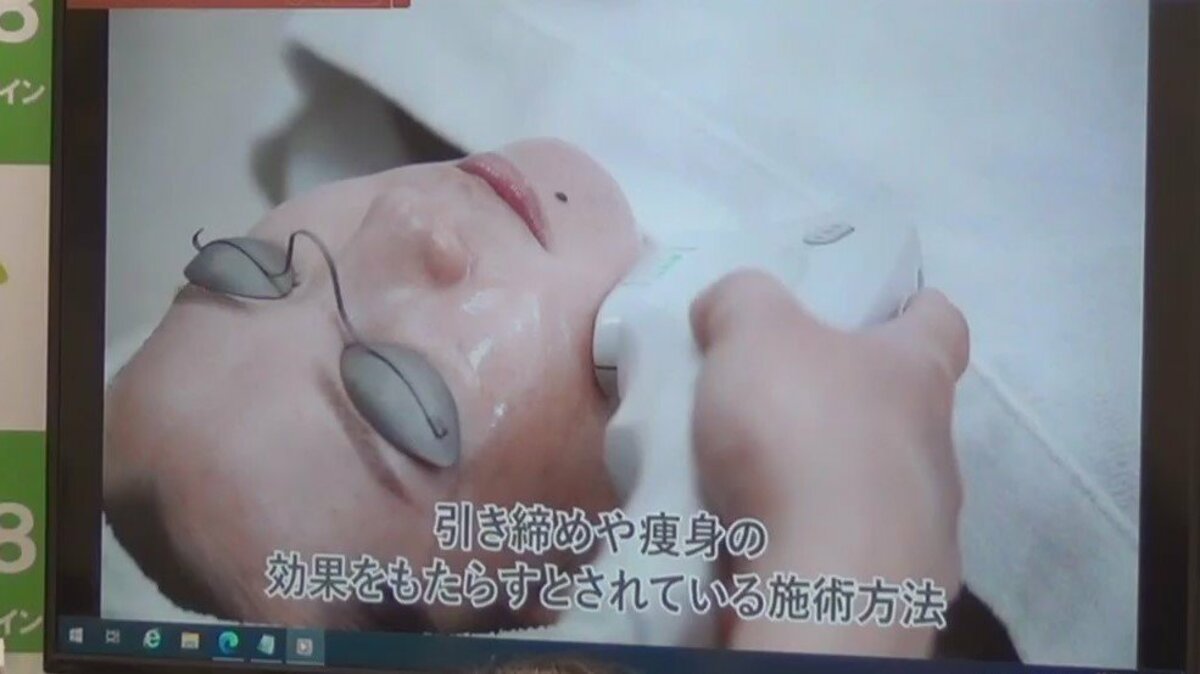 痩身効果うたう「HIFU」でまひや急性白内障…調査委、施術は「解剖学の