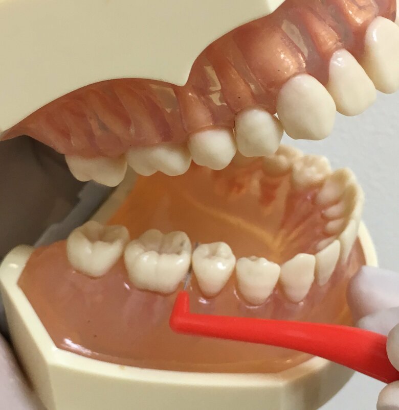 歯間ブラシは主に奥歯で使用（提供：アンチエイジングデンタルクリニック恵比）