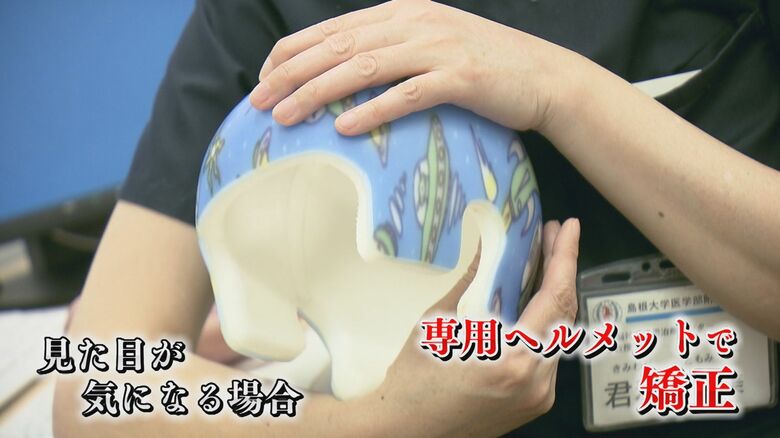 ヘルメットによる矯正も有効