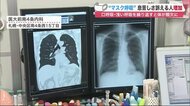 「マスク呼吸」で息苦しさ訴える人が増加…酸欠状態作り感染症リスクもUP　正しい呼吸法は【北海道発】