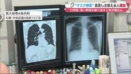 「マスク呼吸」で息苦しさ訴える人が増加…酸欠状態作り感染症リスクもUP　正しい呼吸法は【北海道発】