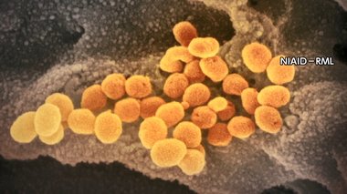葬儀で新型コロナウイルス集団感染…最後を看取れない可能性も…