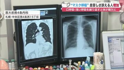 「マスク呼吸」で息苦しさ訴える人が増加…酸欠状態作り感染症リスクもUP　正しい呼吸法は【北海道発】