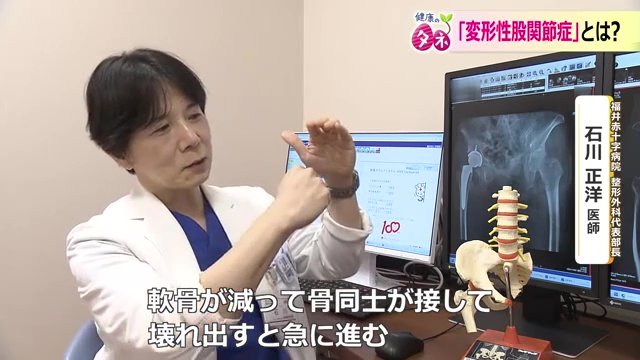 福井赤十字病院の石川正洋医師