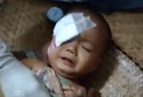 Myanmar Now