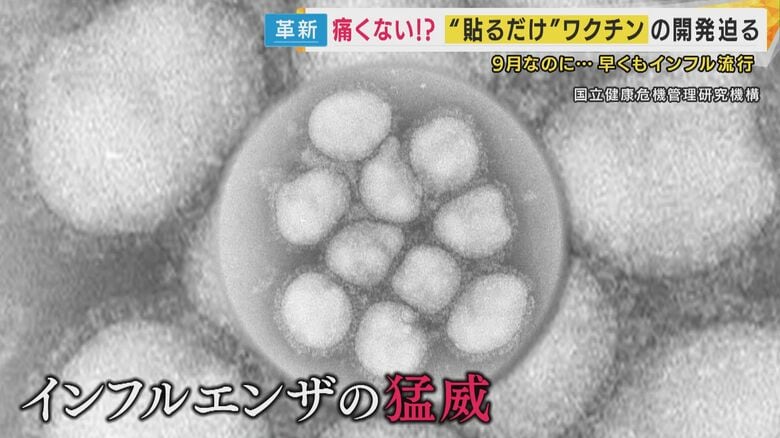 暑いのに“インフル猛威”で学級閉鎖相次ぐ　来年以降も夏の流行続く可能性　開発進む“貼るワクチン”｜FNNプライムオンライン