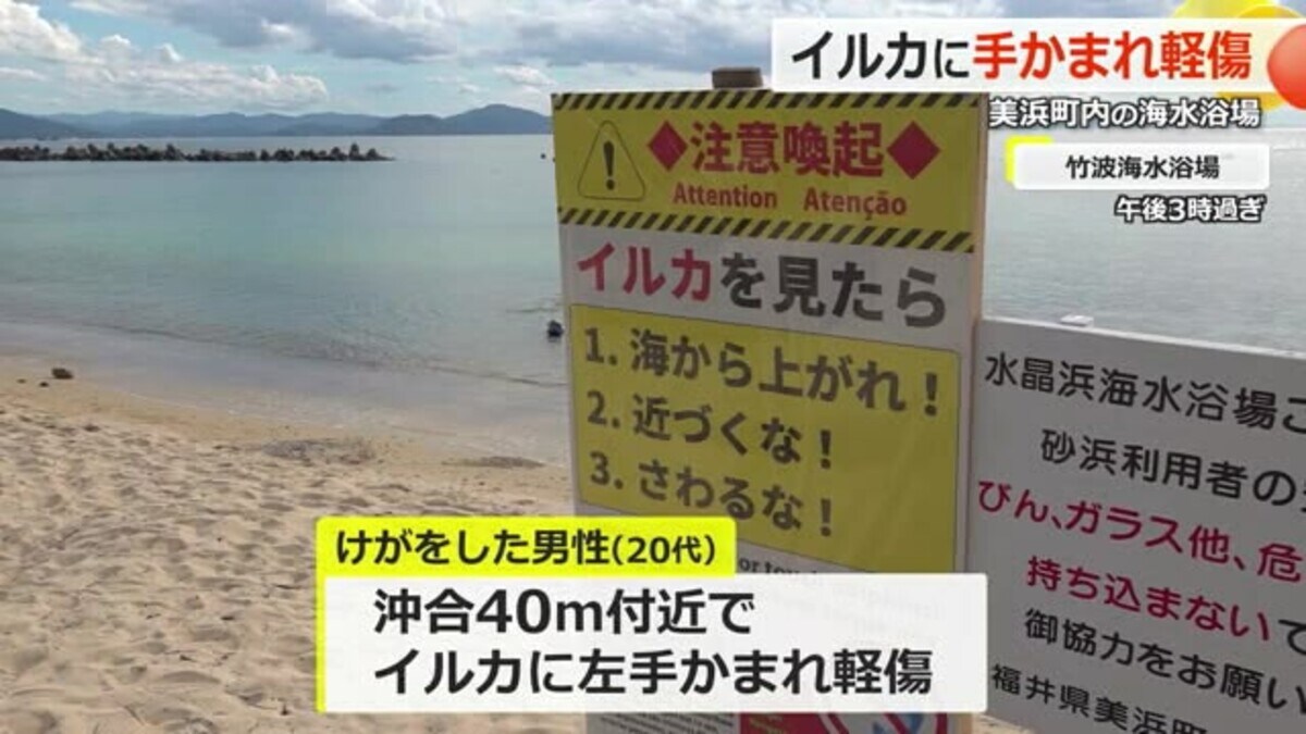 野生イルカにかまれ左手をけが 美浜町の海水浴場で愛知県の20代男性【福井】｜FNNプライムオンライン