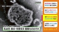 乳幼児は肺炎など引き起こすおそれも 「RSウイルス感染症」静岡で過去最多