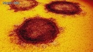 新型コロナ 新たに28人の感染確認 重症者2日連続増で5人に【愛媛】