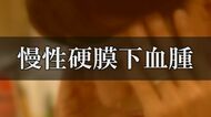 物忘れが増えた、歩きづらい…　それ、認知症じゃなくて「慢性硬膜下血腫」かも　“軽い頭のけが”と放置しないで　受診の目安を専門医に聞いた