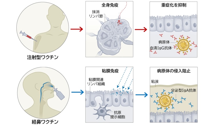鼻から投与する「経鼻ワクチン」、感染予防の新たな切り札に~千葉大学とUCSDが最新動向を総まとめ