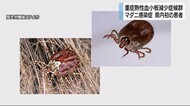 マダニ感染症「重症熱性血小板減少症候群」静岡県内初の患者発生