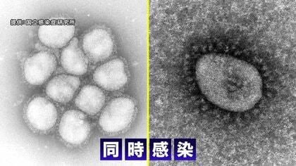新型コロナ＆インフル“同時流行”に注意 併発で重症化のおそれも【岩手