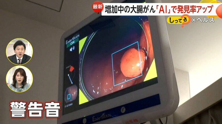 隆起物を見つけ、警告音とともに画面が黄色くなる「AI内視鏡」