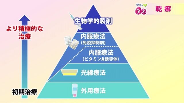 乾癬の治療法