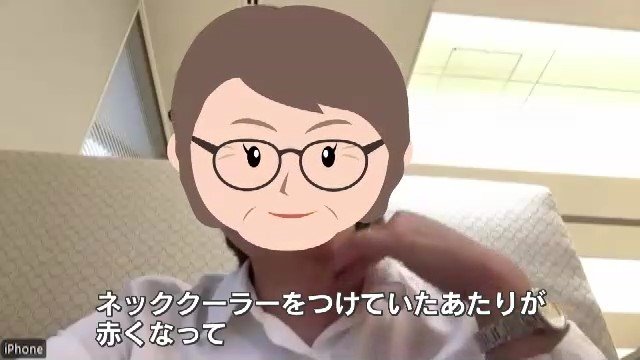 ネッククーラーで肌にかゆみがでた女性