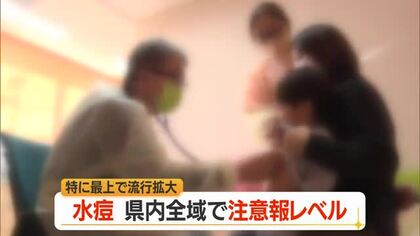 子どもに多い水痘（水ぼうそう）流行・3カ月ぶり注意報レベル　県全体で1.24人・最上4.0人　山形
