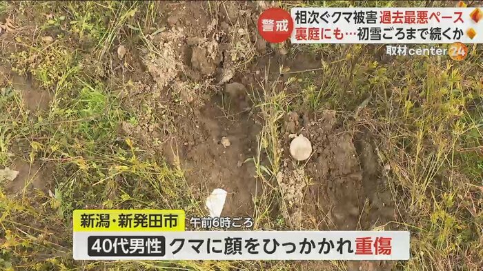 新潟・新発田市では40代男性がクマに顔を引っかかれ重傷