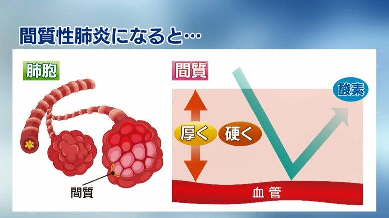 肺が硬くなり、呼吸機能が低下してしまう