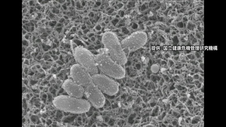 【速報】「百日咳」新規感染者数が過去最多…初めて1週間あたり感染者数が3000人上回る　「リンゴ病」新規感染者数も最多に｜FNNプライムオンライン