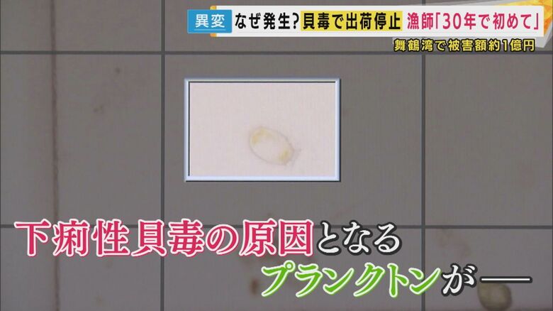 プランクトンの「アキュミナータ」