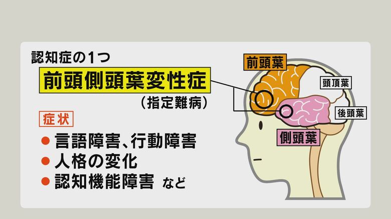 修さんが診断を受けた前頭側頭葉変性症とは
