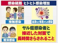 国内初のサル痘感染確認　専門家｢いったん広がれば家庭でも…｣…