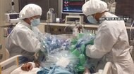「新型コロナ患者数減少を実感」人工呼吸器治療の担当医師