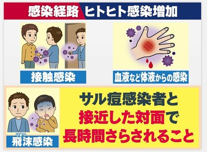 国内初のサル痘感染確認　専門家｢いったん広がれば家庭でも…｣間接的な接触でも感染の可能性