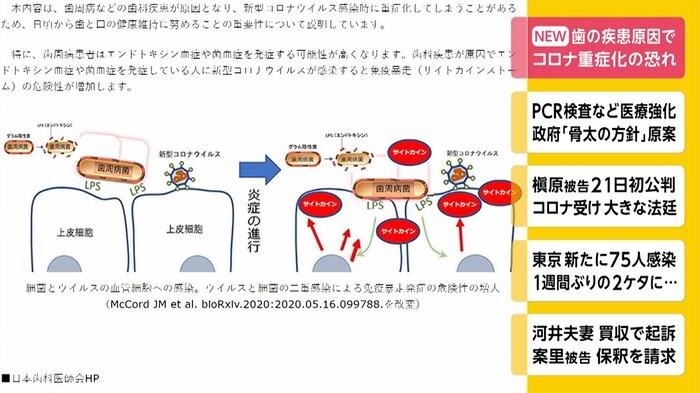 歯の疾患原因で コロナ重症化のおそれ