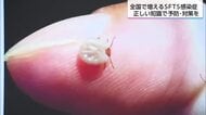 マダニが媒介する感染症SFTS　過去最多のペースで急増　対策は