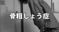 「大腿骨骨折の5年生存率は50％」国内患者1590万人「骨粗しょう症」　20歳前後から下降する骨量　将来のために対策は幼少期から