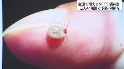 マダニが媒介する感染症SFTS　過去最多のペースで急増　対策は