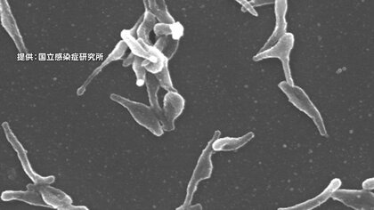 「マイコプラズマ肺炎」全国患者数5週連続増加で過去最多更新…厚労省「例年より感染の広がり著しい」手洗いやマスク着用など感染対策呼びかけ