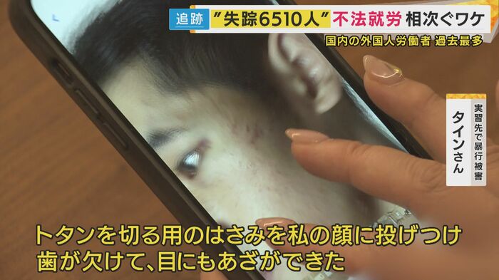 タインさん