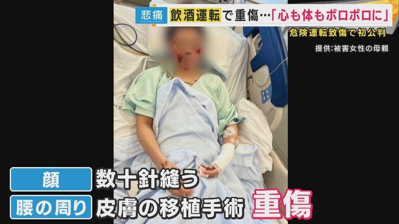 被害女性「傷痕ずっと残る。同じ痛み味わって」飲酒運転で危険運転致傷罪に問われた女　裁判で認否「留保」｜FNNプライムオンライン