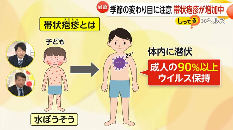 子供の頃に罹った水ぼうそうと同じウイルスが原因となる帯状疱疹