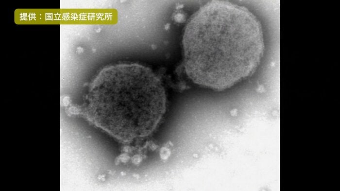 赤ちゃんがかかると重症化することもある『RSウイルス感染症』