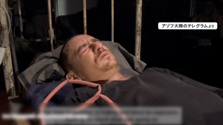 症状を訴える人